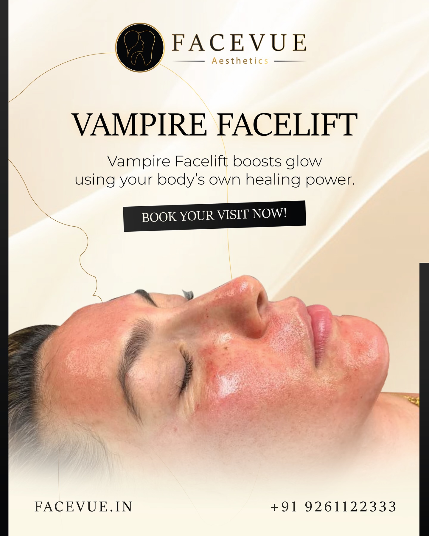 Vampire Facelift at Facevue Aesthetics uses PRP therapy to boost collagen, reduce fine lines, and reveal naturally youthful, radiant, glowing skin.

Book your transformation today. ✨
.
.
.
.
#VampireFacelift #FacevueAesthetics #PRPTreatment #YouthfulSkin #SkinRejuvenation #CollagenBoost #GlowFromWithin #AntiAgingTreatment #NaturalBeauty #RadiantSkin #AestheticClinic #JaipurAesthetics #AdvancedSkincare #FacialRejuvenation